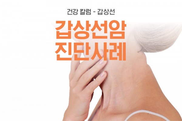 황금빛 Dr. 갑상선암 진단 사례 안내 이미지