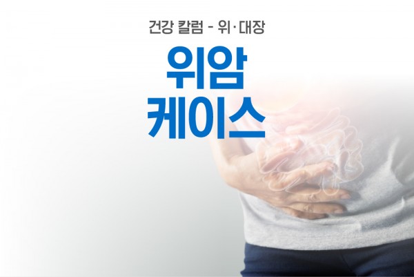 황금빛 Dr. 재검으로 진단된 위암 Case 안내 이미지