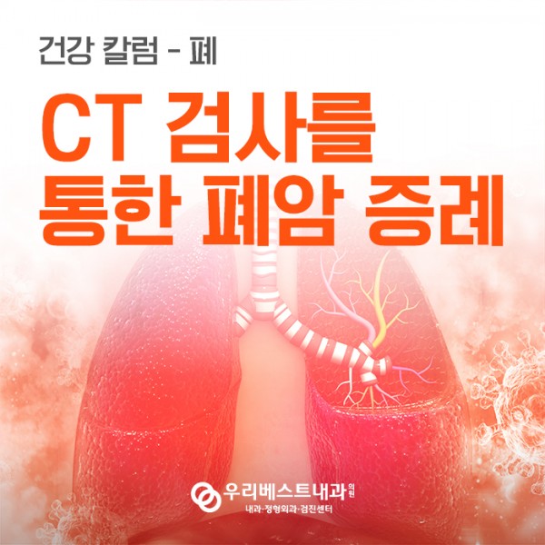 황금빛 Dr. CT검사를 통한 폐암 증례 안내 이미지