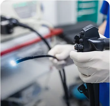 소화기 내시경 검사 장비 이미지